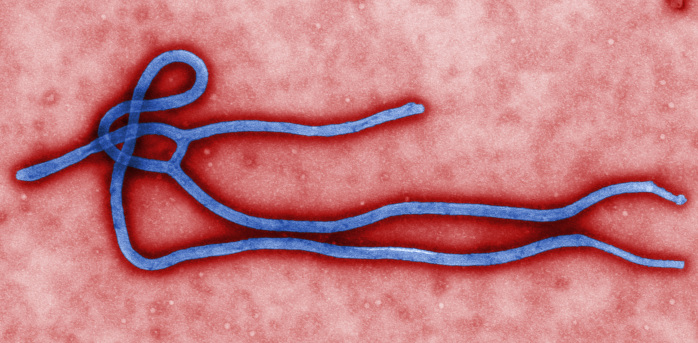 AFP/CDC/Cynthia Goldsmith
