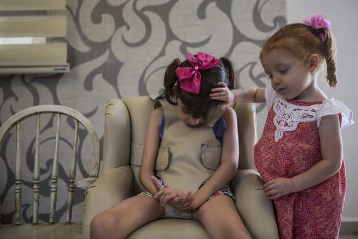 Valentina Elizalde, 2, right, comforts her sister Grace as she goes through one of her hourly convulsions in the living room of their home in Monterrey, Mexico, on August 12, 2015.